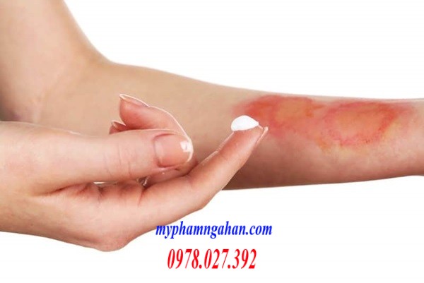 kem-boi-tri-bong-evo-panthenol-phuc-hoi-chi-sau-5-ngay-su-dung-2 (1)