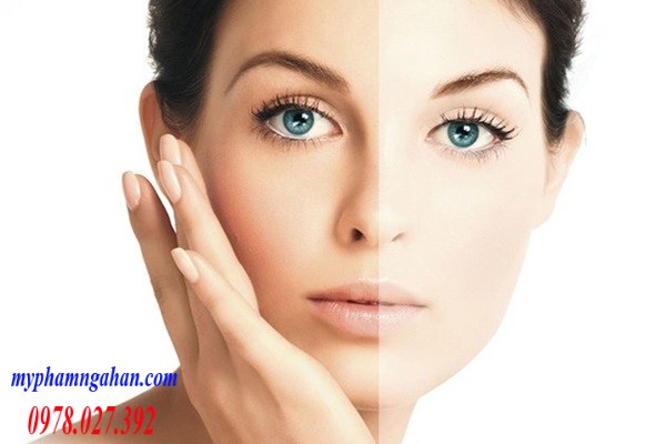 kem-duong-trang-da-spot-treatment-natural-siberica-lam-trang-va-mem-da-2 (1)